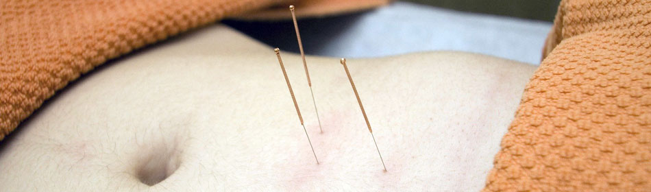 Accupuncture, Eastern Healing Arts in the Quakertown, Bucks County PA area